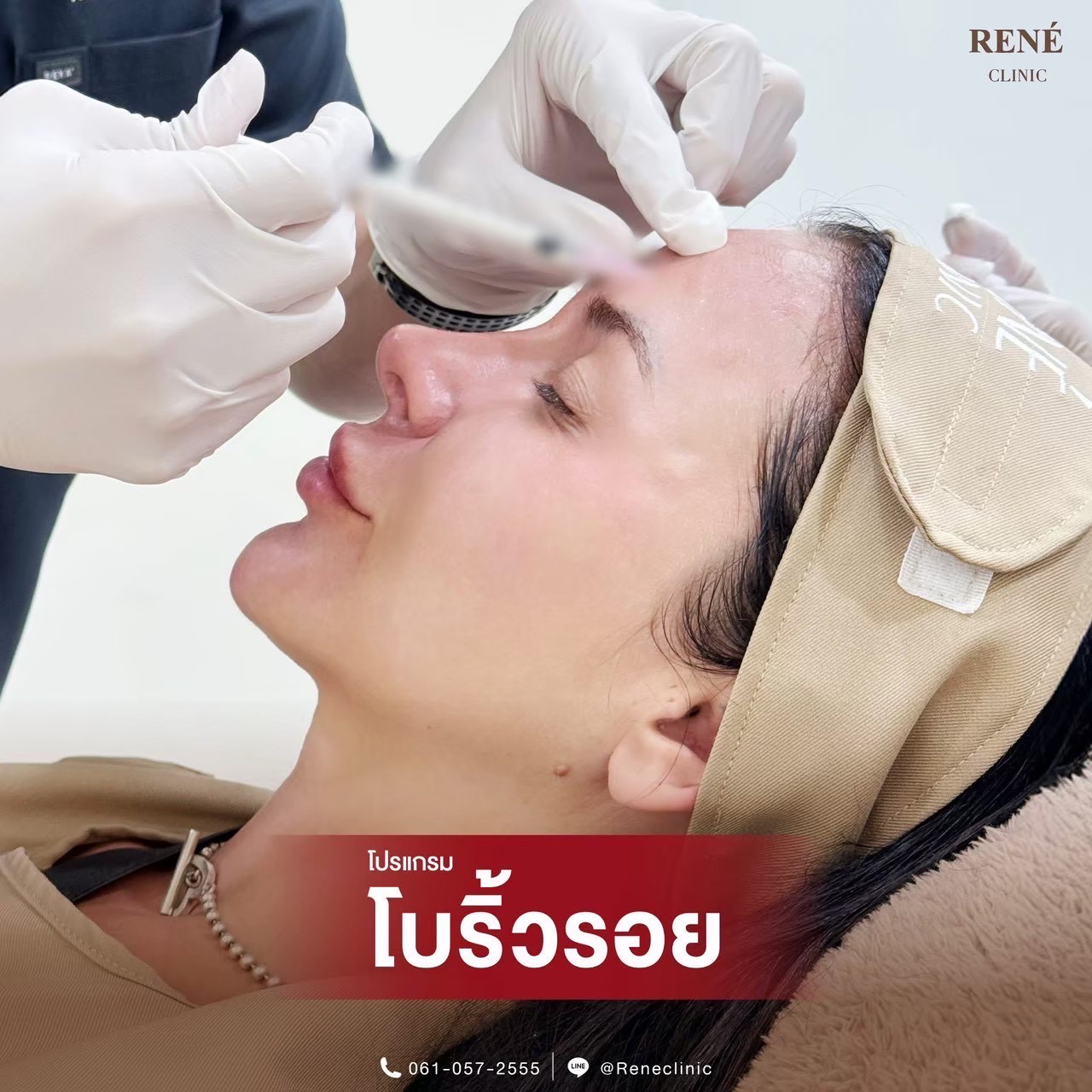 รีวิว Botox #12